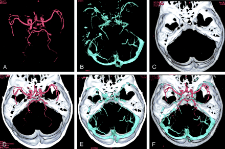 Fig 2.