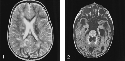 Fig 2.
