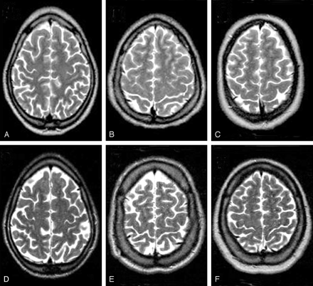 Fig 1.