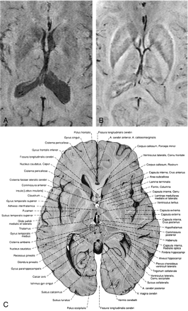 Fig 3.