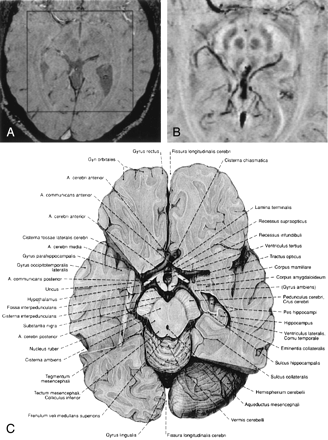 Fig 4.