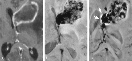 Fig 5.