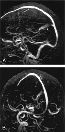 Fig 1.