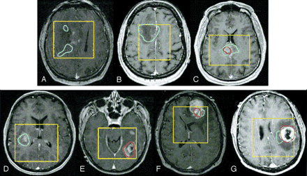 Fig 1.