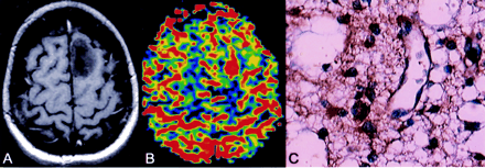 Fig 3.