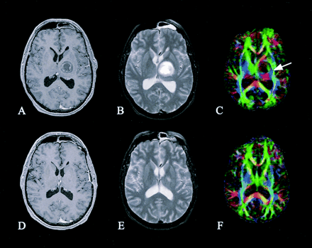 Fig 3.