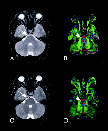 Fig 5.