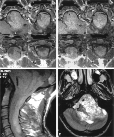 Fig 1.