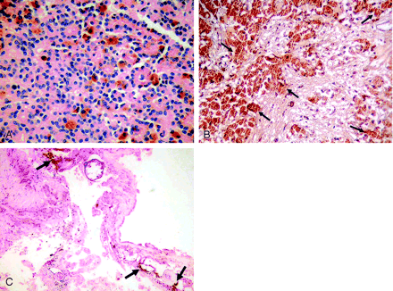 Fig 4.