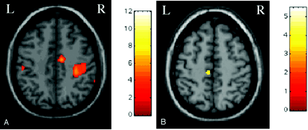 Fig 2.