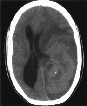 Fig 1.