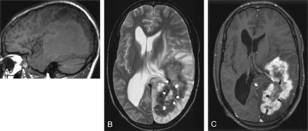 Fig 2.