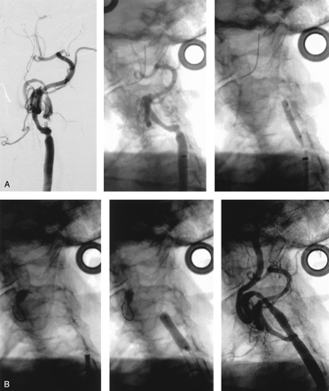 Fig 3.