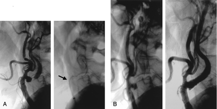 Fig 4.