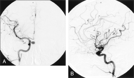 Fig 1.