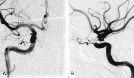 Fig 2.