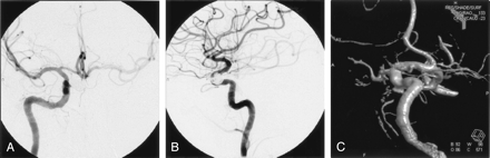 Fig 3.