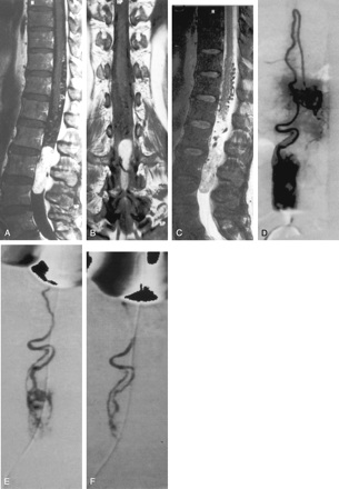 Fig 3.