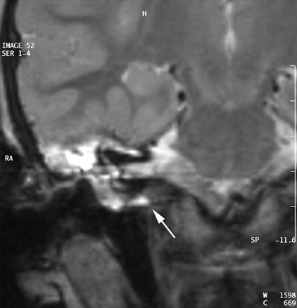 Fig 4.