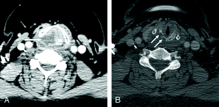 Fig 1.