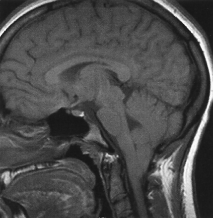 Fig 2.
