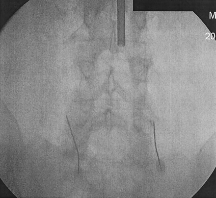 Fig 2.