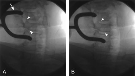 Fig 2.