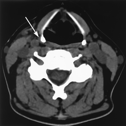 Fig 4.