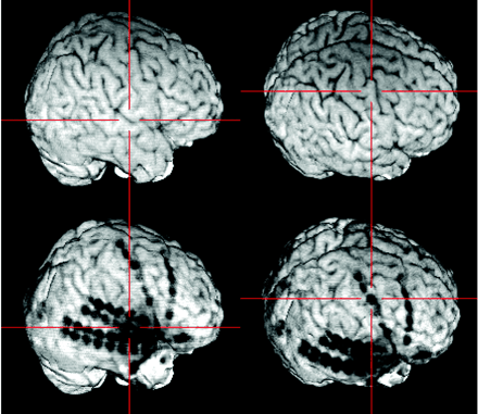 Fig 3.