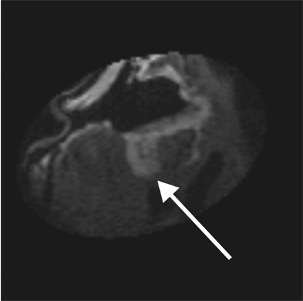 Fig 3.