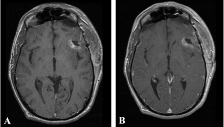 Fig 4.