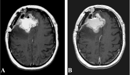 Fig 5.