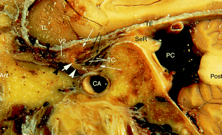 Fig 1.