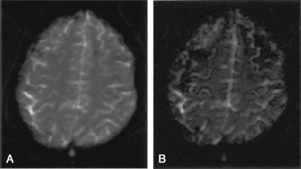 Fig 1.