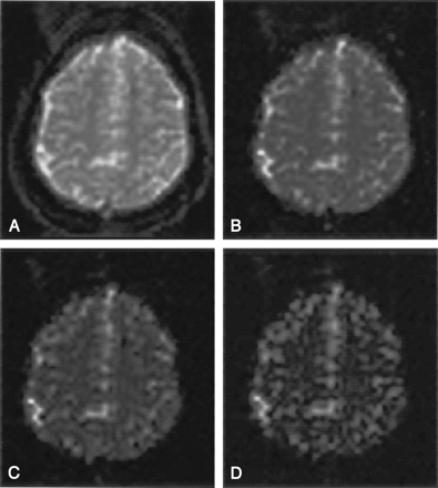 Fig 2.