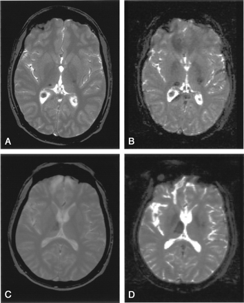 Fig 3.