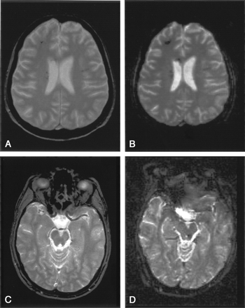 Fig 4.