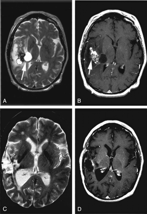 Fig 4.