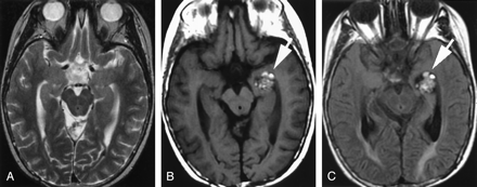Fig 1.