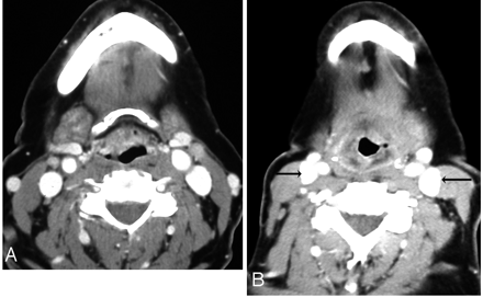 Fig 1.