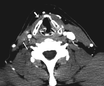 Fig 3.
