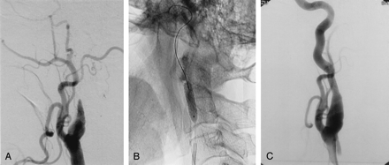 Fig 4.