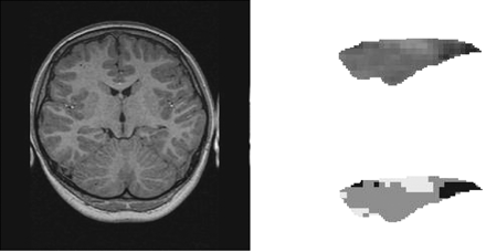 Fig 1.