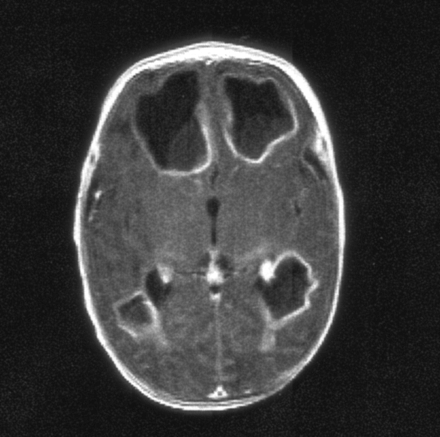 Fig. 4.