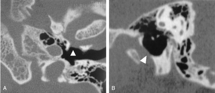 Fig 1.