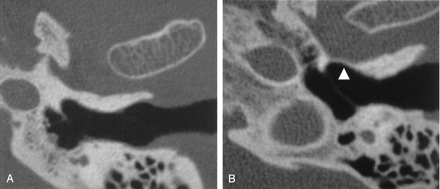 Fig 2.