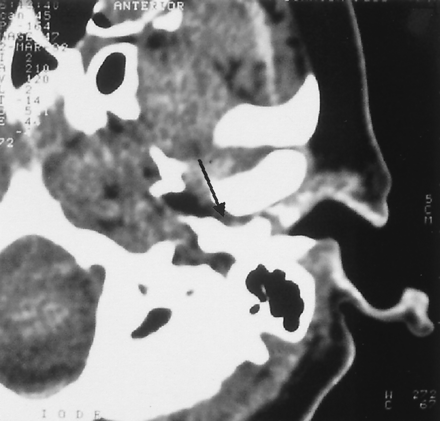 Fig 3.