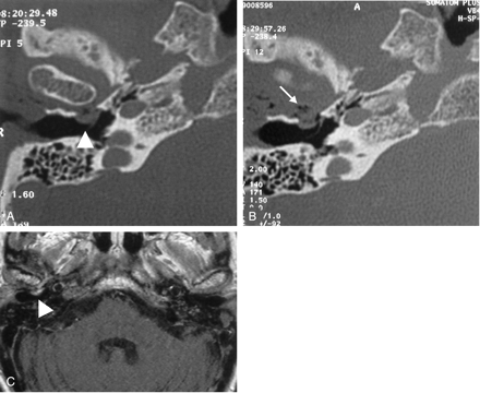Fig 4.