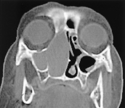 Fig 1.
