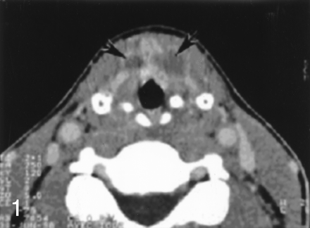 Fig 1.